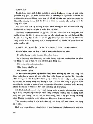 NHIỄU ÁNH
Ngoài nhũng nhiễu anh do kim loại nội sọ hoặc à da đầu gây ra, các rối loạn trong
qua trình máy quét, qua trình xù lý dứ kiện, ta còn thấy hai loại nhiễu ảnh hình vệt
và hình đốm trên ảnh không tuông ứng vói bất kỳ một cấu trúc nào trong xương sọ.
Các nhiễu ảnh này thường khá đặc hiệu nên hiếm khi nào dẫn đến nhũng nhằm lẫn
trong chẩn đoán.
Các nhiễu ảnh hình vệt thường do bệnh nhân không yên tĩnh lúc máy quét,ống
dẫn luu nội sọ cũng có thế gây ra nhiễu ảnh loại này.
Các nhiễu ánh kiểu đóm đôi khi gây khó khăn cho chẩn đoán. Các vùng giảm dậm
ò phần nền sọ, đặc biệt là vùng trung tâm sau trần hố mắt, sau các cánh bướm và tháp
đá. Các đốm tăng đậm ỏ tiếu não có thể gặp ỏ khu vực phía sau các vệt nhiễu của
xương nền sọ. cắt các lốp mòng hon và những máy tiến bộ hon có thế giảm nhiêu các
nhiễu ảnh loại này.
2. HÌNH ẢNH CHỤP CẮT LỚP VI TÍNH TRONG CHẤN THƯƠNG sọ NÃO
2.1. Chỉ dinh chụp cát lớp vi tinh trong chân thương sọ náo.
- Đa chấn thương sọ não cần can thiệp phẫu thuật.
- Có triệu chúng thần kinh ngay sau chấn thương hoặc sau khoảng tĩnh: suy giảm
vận động, rối loạn ý thức, rói loạn co tròn, giãn dồng tử....
• Hội chúng chảy máu màng não.
- Chấn thương gây lốm sọ.
- Yêu càu của y pháp.
2.2. Hình ảnh chụp cát lớp vi tính trong chấn thương sọ não kín: trong thòi
bình, chấn thương sọ não kín gặp nhiều hon chấn thương sọ não hò. Tác nhân gây
chấn thương làm biến dạng nhất thòi hộp sọ và thúc đầy sụ va đập của phần xương
sọ vào não bộ, nhung màng cứng không bị rách. Tổ chức bên trong bị giập và mạch
máu bị xoắn văn, gây ra nhữngổ máu tụ, phù não, hình thành một hoặc nhiêu khoang
choán chỗ nội sọ có thề nhận biết trên ảnh chụp cắt lóp vi tính.
2.3. Hỉnh ảnh chụp cắt lớp vi tính trong máu tụ ngoài màng cứng: máu tụ
ngoài màng cúng thuồng xuất hiện ỏ mặt trong xương sọ do chảy máu của động mạch
màng não giũa. Màng cứng sẽ tách ròi khỏi xuong, máu tụ lại giữa xuong và màng
cứng. Thường gặp máu tụ ngoài màng cứng kèm theo võ xương hộp sọ.
Trên lâm sàng thường là một bệnh cảnh cấp tính do sụ xuất hiện nhanh tình trạng
dè ép não.
Hình máu tụ ngoài màng cúng hiện ra là mộtổ tăng đậm, có tý trọng đặc hiệu cùa
114
 