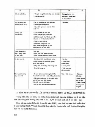 (1) (2) (3) (<)
cắt đút mô trắng - Tăng lý trọng khu trú chày máu DAO thát
- Phù não lan tỏa
Dường giũa thè trai.
náo thắt 3. cuống não.
củ não sinh tư
Phù và phổng não
an tòa (nguôi trẻ )
- Dè ép đổi xúng các nào thát bên
- Dường giữa không lệch
- Xóa rãnh sylvius và xóa các rãnh
cuộn não
Chắt trắng
Tụt kẹt qua
lén tiêu não
- Xóa một bén bé trẽn yên
- Giãn rộng bể gian cuống não
và bẻ tĩnh mạch lòn, bẻ cùa góc cáu
tiểu não và bể khuyết lêu tiêu não
- Xoay cù não sinh tứ
- Nhũn nao vùng chàm (do
động mạch não giũa bị ép vào
bò lự do cùa lêu tiểu não)
Thông động mạch
rành - xoang hang
do sang chẩn
- Lỗi mắt
- Giãn rộng tĩnh mạch mắt trẽn
- Giãn khoang tính mạch xoang hang
Rò dịch não tùy - Dứt đoạn hình liên tiếp cùa xương
- Dịch não tùy có thuốc càn quang
rò ra khỏi hộp sọ
- Tăng đậm bái thường một xoang mặt
- Tràn khí trong sọ
- Lá sàng
- Xoang trán
(thành sau)
- Xoang bướm
- Trân hàm nhổ
của xương đá
Máu tụ dưới màng
rưng mạn tính
- Ô giàn tỳ trọng sát xương hình liêm
hoặc hình thấu kính 1 mặt phẳng, 1 mặt lồi
-'Dấu hiệu choán ché rõ nét: rãnh cuộn
não, bể não, não thất bẽn xẹp
Não thất bẽn dối diện giãn
- Tụi kẹt não thất bên dưới Mém não
•
Trán - thái dương
- Tỳ trọng
hỗn hợp
- Đổng tỳ trọng
vói mồ não
- Tăng tỳ trọng
do chảy máu
lái phát
3. HÌNH ẢNH CHỤP CẮT LỚP VI TÍNH TRONG BỆNH LÝ THẦN KINH TRẺ EM
Trong năm đầu sau sinh, các triệu chứng thần kinh hay gặp đi kèm vói dị tật bắm
sinh và nhũng tổn thương chu sinh là 0.1 - 0,9% trẻ mói sinh có dị tật não - tủy.
Ngạt gây ra những biến dồi ỏ não bộ vào thòi kỳ chu sinh hay sau sinh nhiêu hon
ỏ tuổi truồng thành. Vê mặt hình thái học, các tổn thuong chu sinh thuồng khó phân
biệt vói các dị tật bầm sinh.
118
 