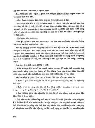 gặp nhất rồi đến chảy máu và nghẽn mạch.
4.1. Nhối máu náo : nguôi ta phân biệt trên giải phẫu bệnh học ba giai đoạn khác
nhau của nhồi máu não.
- Giao đoạn nhũn não kèm theo phù não trong và ngoài tế bào.
- Giai đoạn dịch hóa là thay đổi tý trọng rõ rệt của tổ chức não và xuất hiện trên
ánh chụp cắt lóp vi tính từ 24-48 giò sau, hình ảnh giảm dậm, giai đoạn này có sụ
phân rỗ của lốp bao myelin và tan nhân của các tế bào thần kinh đệm. Hiện tượng
trên kết họp vói qua trình thục bào tăng dàn của các tế bào mỡ có hạt (microgliocyte
và histiocyte).
- Giai đoạn kén nhũn não.
Đánh giá định khu của nhồi máu não có thề dựa trên so đồ cấp máu của ."Ị dộng
mạch não và động mạch sống - nền.
Mức độ hay gặp của các động mạch bị tắc có thế xếp theo thú tụ sau: động mạch
não giũa - động mạch não trước • động mạch não sau - động mạch nền; cũng có thế
gặp phối họp của hai động mạch não. Khi có hiện tượng phối họp của hai dộng mạch
não trò lên thì khả năng hẹp ỏ động mạch cảnh hoặc viêm tắc động mạch càng tăng;
nhất là ỏ bệnh nhân trê tuổi, càn làm sáng tỏ các nghi ngó nói trên bằng chụp dộng
mạch.
Dấu hiệu trên ảnh chụp cắt lóp vi tính:
- Giảm tỷ trọng khu trú có lan tòa cả vỏ não theo so đồ phân phối máu của tùng
động mạch. Vùng giảm đậm thường có hình thang (động mạch não giũa), hình cho
nhật (động mạch não truóc) hoặc hình dấu phay (nhồi máuở vùng sâu).
Khu vục giảm tý trọng có sụ thay đồi theo thòi gian nếu được chụp lại.
+ Tuần Ì: giảm đậm không rõ bò, có khi giảm đậm không' đồng đều tại một vùng
khu vục.
+ Tuần 2: bò của vùng giảm đậm rõ dàn. Cũng có khi vùng giảm tỳ trọng trỏ nên
dồng tỷ trọng trong khoang tù tuần thú 2, tuân thứ 3.
+ Sau Ì tháng: diện giảm đậm thu hò hơn, bò rõ hon, nhung múc độ giảm dậm
tăng lên ( tý trọng dịch).
- Dấu hiệu choán chỗ thường xuất hiện ó tuần lễ đầu và giảm dần theo thòi gian.
Khi đã hình thành kén nhũn não lại có hiện tượng co kéo, và giãn khu trú phần não
thất bên sát vói kén cũng nhu hình ảnh rộng và sâu hon cùa các cuộn não tuông úng
vói vùng thiếu máu. Các dấu hiệu này thề hiện tình trạng teo não khu trú sau nhồi máu.
122
 