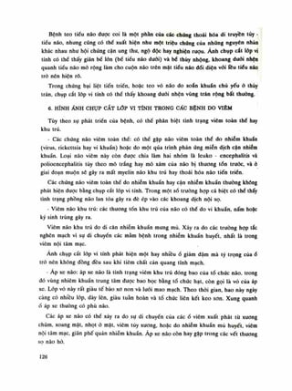 Bệnh teo tiểu não được coi là một phần của các-chúng thoái hóa di truyền tủy -
tiểu não, nhung cũng có thề xuất hiện nhu một triệu chúng của những nguyên nhàn
khác nhau nhu hội chúng cận ung thu, ngộ độc hay nghiện rượu. Ảnh chụp cắt lốp vi
tính có thế thấy giãn bể lòn (bế tiếu não đuôi) và bể thúy nhộng, khoang đuôi nhộn
quanh tiểu não mỏ rộng làm cho cuộn não trẽn mạt tiểu não đổi diện vối lều tiêu náo
trò nên hiện rõ.
Trong chứng bại liệt tiến triển, hoặc teo vỏ não do xoắn khuẩn chủ yếu ỏ thúy
trán, chụp cắt lóp vi tính có thề thấy khoang đuôi nhện vùng trán rộng bất thường.
6. HÌNH ẢNH CHỤP CẮT LỚP VI TÍNH TRONG CÁC BỆNH DO VIÊM
Tùy theo sự phát triền cùa bệnh, có thế phân biệt tình trạng viêm toàn thè hay
khu trú.
- Các chứng não viêm toàn thế: có thể gặp não viêm toàn thè do nhiễm khuẩn
(virus, rickcttsia hay vi khuẩn) hoặc do một qua trình phản úng miễn dịch cận nhiễm
khuẩn. Loại não viêm này còn dược chia làm hai nhóm là leuko - encephalitis và
polioencephalỉtis tùy theo mô trắng hay mô xám cùa não bị thương tổn trước, và ỏ
giai đoạn muộn sẽ gây ra mất myelin não khu trú hay thoái hóa não tiến triến.
Các chúng não viêm toàn thế do nhiễm khuẩn hay cận nhiễm khuẩn thuồng khống
phát hiện duọc bằng chụp cắt lóp vi tính. Trong một số trường họp cá biệt có thể thấy
tình trạng phồng não lan tỏa gây ra đè ép vào các khoang dịch nội sọ.
- Viêm não khu trú: các thương tổn khu trú của não có thể do vi khuẩn, nấm hoặc
ký sinh trùng gây ra.
Viêm não khu trú do di căn nhiễm khuẩn mung mủ. Xảy ra do các trường họp tắc
nghẽn mạch vì sụ di chuyến các mâm bệnh trong nhiễm khuẩn huyết, nhất là trong
viêm nội tâm mạc.
Anh chụp cắt lóp vi tính phát hiện một hay nhiều ổ giảm dặm mà tỷ trọng củaổ
trò nên không đồng đều sau khi tiêm chất càn quang tĩnh mạch.
- Áp xe não: áp xe náo là tình trạng viêm khu trú đóng bao của tổ chức não, trong
đó vùng nhiêm khuẩn trung tâm đuọc bao bọc bằng tồ chức hạt, còn gọi là vó của áp
xe. Lốp vỏ này rất giàu tế bào xo non và luói mao mạch. Theo thòi gian, hao này ngày
càng có nhiều lóp, dày lên, giàu tuần hoàn và tổ chúc liên kết keo son. Xung quanh
ố áp xe thuồng có phù não.
Các áp xe náo có thể xây ra do sụ di chuyển của cácổ viêm xuất phát tù xuong
chũm, xoang mặt, nhọt ỏ mặt, viêm tủy xương, hoặc do nhiễm khuẩn mủ huyết, viêm
nội tâm mạc, giãn phế quản nhiễm khuẩn. Áp xe náo còn hay gặp trong các vết thương
sọ não hò.
126
 