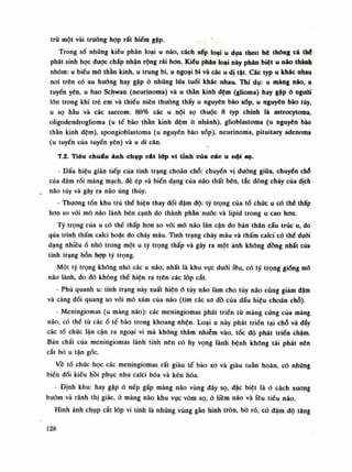 trừ một vài trường họp rất hiếm gặp.
Trong số nhũng kiểu phân loại u não, cách xếp loại u dựa theo hệ thông cá thế
phát sinh học được chấp nhận rộng rái hon. Kiểu phân loại này phân biệt u não thành
nhóm: u biếu mô thần kinh, u trung bì, u ngoại bì và các u dị tạt. Các typ u khác nhau
noi trên có xu huống hay gặp ò nhúng lúa tuổi khác nhau. Thí dụ: u màng não, u
tuyến yên, u bao Schwan (neurinoma) và u thần kinh đệm (glioma) hay gặp ỏ nguôi
lãn trong khi trẻ em và thiếu niên thường thấy u nguyên bào xốp, u nguyên bào tủy,
u sọ hầu và các sarcom. 80% các u nội sọ thuộc 8 typ chính là astrocytoma,
oligodendroglioma (u tế bào thần kinh đệm ít nhánh), glioblastoma (u nguyên bào
thần kinh đệm), spongioblastoma (u nguyên bào xốp), neurinoma, pituitary adenoma
(u tuyến của tuyến yên) và u di căn.
7.2. Tiêu chuẩn ảnh chụp cát lóp vi tính của các u nội sọ.
- Dấu hiệu gián tiếp của tình trạng choán chỗ: chuyên vị dường giữa, chuyến chỗ
của đám rối màng mạch, đè ép và biến dạng của não thất bên, tắc dòng chảy của dịch
não túy và gây ra não úng thủy.
- Thương tổn khu trú thè hiện thay đối đậm độ: tỷ trọng của tổ chúc u có thè thấp
hon so vối mô não lành bên cạnh do thành phần nước và lipid trong u cao hon.
Tỷ trọng của u có thể thấp hon so vối mô não lân cận do bản thân cấu trúc u, do
qua trình thấm calci hoặc do chảy máu. Tinh trạng chày máu và thấm calci có thè đuôi
dạng nhiềuổ nhỏ trong một u tỷ trọng thấp và gây ra một ảnh không đồng nhất của
tình trạng hỗn họp tý trọng.
Một tý trọng không nhỏ các u não, nhất là khu vục đuối lều, có tỷ trọng gióng mô
não lành, do đó không thể hiện ra trên các lóp cắt.
- Phù quanh u: tình trạng này xuất hiện ỏ tủy não làm cho tủy não cũng giảm đậm
và càng đối quang so vói mô xám của não (tìm các so đồ của dấu hiệu choán chỗ).
- Meningiomas (u màng não): các meningiomas phát triển tù màng cúng của màng
não, có thế từ cácổ tế bào trong khoang nhện. Loại u này phát triển tại chỗ và đấy
các tổ chức lận cận ra ngoại vi mà không thâm nhiễm vào, tốc độ phát triến chậm.
Bản chất của meningiomas lành tính nên có hy vọng lành bệnh không tái phát nên
cắt bỏ u tận góc.
Vê tồ chức học các meningiomas rất giàu tế bào xo và giàu tuần hoàn, có nhũng
biến đồi kiểu hồi phục nhu calci hóa và kén hóa.
- Định khu: hay gặp ỏ nếp gấp màng não vùng đáy sọ, đặc biệt là ò cách xương
bướm và rãnh thị giác, ò màng náo khu vục vòm sọ, ỏ liềm náo và lều tiểu náo.
Hình ảnh chụp cắt lóp vi tính là nhũng vùng gàn hình tròn, bò rõ, có đậm độ tăng
128
 