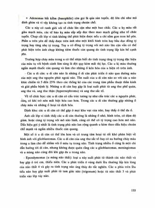 + Adenomas bắt kiêm (basophilic) còn gọi là qua sản tuyến, độ lỏn chi nhu mũ
dinh ghim và vì vậy không tạo ra tình trạng choán chỗ.
Các u này có ranh giói vói tổ chúc lân cận nhu một bao chắc. Các u kỵ màu rất
giàu mạch máu, các tế bào kỵ màu sắp xếp dọc theo mao mạch giống nhu tố chúc
tuyến. Chụp cắt lớp vi tính không thể phát hiện đuọc nếu u chi nằm gọn tron hố yên.
. Phàn u trên yên dễ thấy đuọc trên ảnh nhu một khối hình tròn hay bầu dục dồng tý
trọng hay tăng nhẹ tỷ trọng. Tuy u có đồng tỷ trọng vói mô não lân cận vẫn có thể
phát hiện trên ảnh chụp không tiêm thuốc cản quang do tình trạng lấp kín bề cạnh
yên.
Truông họp chảy máu trong u có thể nhận biết do tình trạng tăng tỷ trọng dặc hiệu
của máu tụ vối bệnh cảnh lâm sàng là đột quy kèm mất thị lục. Các u kị màu thường
ngấm mạnh thuốc cản quang và làm cho nhũngổ kén hóa cùa u hiện rõ trên ảnh.
- Các u di căn: u di căn não là nhữngố di căn phát triển ỏ não qua dường máu
cùa một ung thu nguyên phát ngoài não. Tần xuất của u di căn não so vói các u não
khác chiếm tù s đến 25% theo các thống kê của các trung tâm phẫu thuật thần kinh
và giải phẫu bệnh lý. Nhũng u di căn hay gặp là loại xuất phát từ ung thu phế quản,
ung thu vú, ung thu thận (hypernepbroma) và ung thu sắc tố.
Ve tổ chức học: các u di căn có cấu trúc tuông tụ nhu cấu trúc các u nguyên phát,
cũng có khi trò nên mất biệt hóa cao hon. Trong các u di căn thường gặp nhũngổ
chảy máu và nhũngổ hoại tủ dịch hóa.
Định khu: các u di căn có thề gặp ò mọi khu vục của não, hay thấy ỏ thề đaố.
Ảnh cắt lóp vi tính thấy các u di căn thuàng là nhũngố nhỏ, hình tròn, có đậm độ
giảm, hoặc cùng tý trọng với mô não lành, cũng có thề có tý trọng cao hon mô não.
Dấu hiệu gọi ý nhất là tình trạng phù não lan rộng quanh u kèm theo dấu hiệu choán
chỗ mạnh và ngấm nhiều thuốc càn quang.
Một số ít u di căn có thể lòn hon và có trung tâm hoại tử rất khó phân biệt về
hình ảnh vói glioblastomas. Các u di căn của ung thu sắc tố hay có xu huống chảy máu
trong u làm cho dễ nhầm vóiổ máu tụ trong não. Tình trạng nhiềuổ cũng là một chi
dẫn huống tối di căn, nhung không được quên rằng các u glioblastomas, meningiomas
và li màng não cũng đôi khi gặp đa u trong não.
- Ependymomas (u màng não thất): loại u này xuất phát tù thành các não thất và
hay gặp ỏ trẻ em, thiếu niên. Các u phát triền ó vùng dưới lều thưòng lấp kín lòng
của não thất 4 và gây ra tình trạng não úng thủy do tắc nghẽn. Các u phía trên lều
tiếu não hay gặp xuất phát tù tam giác não (trigonum) hoặc tù não thất 3 và phát
triền vào lóp tùy não.
133
 