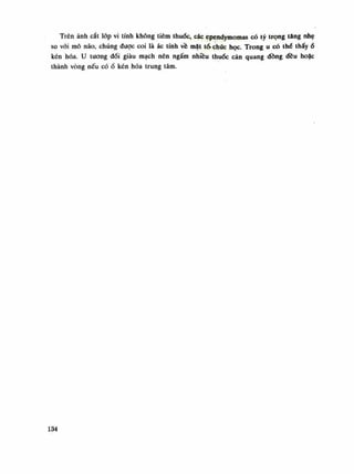 Trên ánh cắt lóp vi tính không tiêm thuốc, các ependymomas có lý trọng tăng nhẹ
so vói mô não, chúng được coi là ác tính về mặt tổ- chức học. Trong u có thè thấy ổ
kén hóa. u tuông đối giàu mạch nên ngấm nhiều thuốc cản quang dồng đều hoặc
thành vòng nếu cóổ kén hóa trung tâm.
134
 