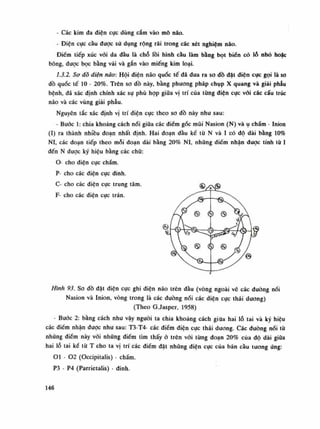 - Các kim đa điện cục dùng cắm vào mô não.
- Điện cục cầu được sử dụng rộng rãi trong các xét nghiệm não.
Điềm tiếp xúc vói da đầu là chỗ lồi hình càu làm bằng bọt biên có lỗ nhỏ hoặc
bông, đuọc bọc bằng vải và gắn vào miếng kim loại.
1.3.2. Sơ đò điện não: Hội điện não quốc tế đã đua ra so đồ đạt điện cục gọi là so
dồ quốc tế lo - 20%. Trên so đồ này, bằng phương pháp chụp X quang và giải phẫu
bệnh, đã xác định chính xác sự phù họp giũa vị trí của tùng diện cực vói các cấu trúc
não và các vùng giải phẫu.
Nguyên tắc xác định vị trí diện cục theo so đồ này nhu sau:
- Bước 1: chia khoảng cách nối giũa các điểm gốc mũi Nasion (N) vàụ chấm - Inion
(ì) ra thành nhiều đoạn nhất định. Hai đoạn đầu ké tù N và ì có dô dài bằng 10%
NI, các đoạn tiếp theo mỗi đoạn dài bằng 20% NI, nhũng điếm nhận được tính tù ì
đến N được ký hiệu bằng các chữ:
O- cho điện cực chẩm.
P- cho các điện cục dinh.
C- cho các điện cục trung tâm.
F- cho các diện cục trán.
Hình 93. So đồ đặt điện cục ghi điện não trên dầu (vòng ngoài vẽ các đường nối
Nasion và Inion, vòng trong là các đường nối các diện cục thái dương)
(Theo G.Jasper, 1958)
- Bước 2: bằng cách nhu vậy nguôi ta chia khoảng cách giữa hai lỗ tai và ký hiệu
các điếm nhận đuọc nhu sau: T3-T4- các điểm điện cục thái dương. Các dường nói tù
những điếm này vói những điếm tìm thấy ỏ trên vói từng đoạn 20% của độ dài giũa
hai lỗ tai kể tù T cho ta vị trí các điềm đặt nhũng diện cục cùa bán cầu tuông úng:
OI - 02 (Occipitalis) - chẩm.
P3 - P4 (Parrietalis) - đinh.
146
 