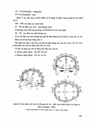 C3 - C4 (Centralis) - trung tâm.
F3 -F4 (Frontalis) - trán.
- Buóc 3: do nửa chu vi NT3 (T4)I, tù N bằng sò phần trăm tuông tụ xác định
vị trí:
FP1 - FP2 các điện cục trán trước.
F7 - F8 các diện cục trán - thái dương trước.
Ỏ khoảng cách 20% độ dài đoạn NT3(T4)I kể tù Ts xác định:
T5 - Tó - các điện cục thái dương sau.
Vị trí các điện cục theo đường dọc giũa krý hiệu bằng chữ z (Zero), ví dụ: Pz, Cz, Fz.
Điện cục tai ký hiệu bằng chú A.
Các điện cục nằn ỏ nửa trái của dầu ký hiệu bằng các cha sổ lè (OI, P3, C3, F3),
ò nửa phải, các cha số chẵn (02, P4, C4, F4).
Có thể sù dụng các chi số bằng chữ thay cho chữ số.
d- Dextra (phía phải) - Od, Pd, Cd, Fd.
s- Sinister (phía phải) • Os, Ps, Cs, Fs. - ^ ^ x
Hình 94. Đặt điện cực theo so đồ quốc tế 10 - 20% trên hình chiếu của hộp sọ
(theo G.Jasper, 1958)
A. Nhìn tù phía bên - B. Nhìn lừ phía trước - c. Nhìn tù trẽn xuồng.
147
 