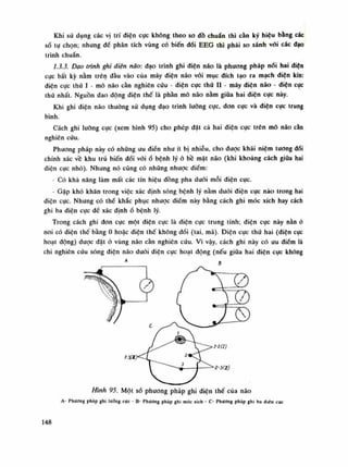 Khi sử dụng các vị trí điện cục không theo so đồ chuẩn thì càn ký hiệu bằng các
số tụ chọn; nhưng để phân tích vùng có biến dổi EEG thì phải so sánh vói các dạo
trình chuẩn.
1.3.3. Đạo trình ghi điện não: đạo trình ghi diện não là phương pháp nói hai diện
cực bất kỳ nằm trên đàu vào của máy điện não vối mục đích tạo ra mạch diện kín:
điện cục thứ ì - mô não cần nghiên cứu - điện cục thú l i - máy điện não - điện cục
thứ nhất. Nguồn dao động điện thế là phần mô não nằm giữa hai diện cục này.
Khi ghi điện não thường sử dụng đạo trình luông cục, don cục và diện cục trung
bình.
Cách ghi luồng cục (xem hình 95) cho phép đặt cả hai diện cục trên mô não càn
nghiên cứu.
Phương pháp này có những uu điển nhu ít bị nhiễu, cho được khái niệm tuông dối
chính xác về khu trú biến dổi vóiố bệnh lý ỏ bề mặt não (khi khoảng cách giữa hai
điện cục nhỏ). Nhung nó cũng có nhúng nhược điểm:
- Có khả năng làm mất các tín hiệu đồng pha dưới mỗi điện cục.
- Gặp khó khăn trong việc xác định sóng bệnh lý nằm dưới điện cục nào trong hai
điện cục. Nhung có thể khắc phục nhược điềm này bằng cách ghi móc xích hay cách
ghi ba diện cục đế xác định ố bệnh lý.
Trong cách ghi don cục một điện cục là điện cục trung tính; điện cục này nằn ỏ
nồi có diện thế bằng 0 hoặc diện thế không dổi (tai, má). Điện cục thứ hai (diện cục
hoạt động) được dặt ó vùng não cần nghiên cứu. Vì vậy, cách ghi này có ưu điểm là
chi nghiên cứu sóng điện não đuối diện cục hoạt dộng (nếu giũa hai diện cục không
Hình 95. Một số phương pháp ghi diện thế của não
A- Phương pháp ghi lưỡng cực - B- Phương pháp ghi móc xích - c- Phương pháp ghi ba điên cúc
148
 