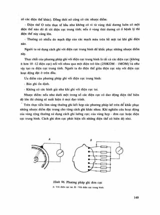 có các diện thế khác). Đồng thòi nó cũng có các nhược điếm:
- Điện thế o trên thục tế hầu nhu không có vì tù vùng thái dương luôn có một
điện thế nào đó đi tói diện cục trung tính; nếu ỏ vùng thái dương cóố bệnh lý thì
điện thế này càng lớn.
- Thường có nhiễu do mạch dập của các mạch máu trên bề mặt tai khi ghi điện
não.
Nguôi ta sù dụng cách ghi vói điện cục trung bình đề khắc phục những nhược điểm
này.
Thục chất của phương pháp ghi vói điện cục trung bình là tất cả các điên cúc (không
ít hon 10 -12 diện cực) nổi vói nhau qua một điện trỏ lốn (250KOM - lMOM)'và nHu
vậy tạo ra điện cực trung tính. Nguôi ta đo điện thế giũa điện cục này vói điện cục
hoạt dộng đặt ỏ trên đầu.
Ưu điếm của phương pháp ghi vối điện cục trung bình:
- Bản ghiổn định.
- Không có các hình giả nhu khi ghi với điện cục tai.
Nhược điếm: nếu nhu đuôi một trong số các điện cục có dao động điện thế biên
độ lốn thì chúng sẽ xuất hiện ỏ mọi dạo trình.
Trên thực tiễn lâm sàng thường ghi kết họp các phương pháp ké trên dế khắc phục
nhũng nhược điềm đặc trung cho tùng cách ghi khác nhau. Khi nghiên cứu hoạt động
của vùng rộng thường sù dụng cách ghi lưỡng cục; cùa vùng hẹp - đon cục hoặc điện
cục trung bình. Cách ghi đon cực phát hiện tốt những điện thế có biên độ nhỏ.
Hình 96. Phương pháp ghi đon cục
A- Với điện cực tai. B - vói điên cục trung bình.
149
 