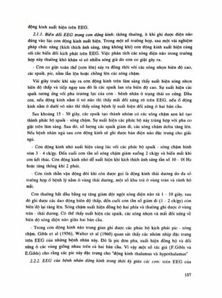 dộng kinh xuất hiện trên EEG.
2.1.1. Biên đối EEG trong cơn động kinh: thông thường, ít khi ghi được diện não
đúng vào lúc cơn dộng kinh xuất hiện. Trong một sò trường họp, sau một vài nghiệm
pháp chức năng (kích thích ánh sáng, tăng không khí) con động kinh xuất hiện cùng
vối các biến dổi kịch phát trên EEG. Việc phân tích các sóng điện não trong truòng
họp này thuồng khó khăn vì có nhiều sóng giả do con co giật gây ra.
• Con co giật toàn thể (con lớn) xảy ra đồng thòi vói các sóng nhọn biên độ cao,
các spaik, pic, nằm lẫn lộn hoặc chồng lên các sóng chậm.
Vài giây trước khi xảy ra con dộng kinh trên lâm sàng thấy xuất hiện sóng nhọn
biên độ thấp và tiếp ngay sau đó là các spaik lan tỏa biên độ cao. Sụ xuất hiện các
spaik tuông ứng vói pha trương lục của con - bênh nhân ó trạng thái co cúng. Đầu
con, nếu động kinh nằm ỏ vỏ não thì thấy mất đối xứng rõ trên EEG, nếu ổ động
kinh nằm ỏ đuôi vỏ não thì thấy sóng bệnh lý xuất hiện đối xúng ò hai bán cầu.
Sau khoảng 15-30 giây, các spaik tạo thành nhóm có các sóng chậm xen kẽ tạo
thành phức bộ spaik - sóng chậm. Sụ xuất hiện các phức bộ này trùng họp vói pha co
giật trên lâm sàng. Sau đó, số lượng các spaik giảm đi, các sóng chậm delta tăng lên.
Nếu bệnh nhân ngủ sau con dỘTig kinh sẽ ghi dược bàn diện náo đặc trung cho giấc
ngủ.
- Con động kinh nhỏ xuất hiện cùng lúc vói các phúc bộ spaik - sóng chậm hình
vòm 3 - 4 ck/gy. Đến cuối con tàn số sóng chậm giảm xuống 2 ck/gy và biến mất khi
con kết thúc. Con động kinh nhỏ dễ xuất hiện khi kích thích ánh sáng tàn số 10 - 18 Hz
hoặc tăng thông khí 2 phút.
- Con tinh thần vận động đôi khi còn được gọi là động kinh thái duong do đa số
trường họpổ bệnh lý nằm ỏ vùng thái dương, một số khu trú ỏ vùng trán và rãnh hố
mắt.
Con thường bắt dầu bằng sụ tăng giảm đột ngột sóng điện não tù Ì - lo giây, sau
dó ghi được các dao dộng biên độ thấp, đến cuối con tần số giảm đi (Ì - 2 ck/gy) còn
biên độ lại tăng lên. Sóng chậm xuất hiện dồng bộ hai phía và thuồng ghi dược ò vùng
trán - thái duong. Có thế thấy xuất hiện các spaik, các sóng nhọn và mất dối xứng về
biên độ sóng điện não giũa hai bán càu.
- Trong con động kinh não trung gian ghi được các phúc bộ kịch phát pic - sóng
chậm. Gibls et ai (1956), Walter et ai (1960) quan sát thấy các nhóm nhịp đặc trung
trên EEG cùa nhũng bệnh nhân này. Đó là pic don pha, xuất hiện dồng bộ và đói
xúng ỏ các vùng giống nhau trên cả hai bán cầu. Vì vậy một số tác già (RGibls và
E.Gibls) cho rằng các pic này đặc trung cho "động kinh thalamus và hypothalamus"
2.2.2. EEG của bệnh nhăn động kinh trong thời kỳ giữa các cơn: trên EEG cùa
157
 