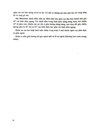 ngăn các sào bào mỏng và bò rõ rệt. Có thế có nhũng sào bào phũ lên tói vùng tháp
đá và vùng gò má.
6.2. Stenvers: bệnh nhân nằm úp. Bình diện dọc giữa của đàu làm thành một góc
45° vói bình diện ngang. Tia chính nằm trong bình diện thẳng đứng hoặc hoi chếch
10° về phía trán. Muốn cho nó vẫn ỏ giữa huống thẳng đúng, nên thay dổi góc chếch
không phải là 45° mà là 55° của bình diện dọc giũa vói bình diện ngang.
Điềm tia vào hoi thấp dưới mấu chẩm trong hoặc ỏ một khoát ngón tay phía đuối
và phía ngoài.
Điềm ra năm giữa đường nối góc ngoài mắt và lỗ tai ngoài (khoảng lem trước xoang
chũm).
14
 