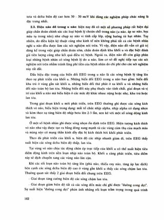 teta và delta biên dô cao hon 30 - 50 mcV khi dùng các nghiệm pháp chúc năng là
đặc trung nhất.
2.3. Điện não dồ trong u não: hiện nay đã có một số phương pháp rất hiện dại
giúp chấn đoán chính xác các loại bệnh lý choán chỗ trong náo (u não. áp xe não, bọc
máu tụ trong não) nhu chụp sọ não vi tính cắp lóp, cộng hường tù hạt nhân. Tuy
nhiên, do diêu kiện kỹ thuật cũng nhu kinh tế nên không phải tất cả các bệnh nhân
nghi u não đêu dược làm các xét nghiệm nói trên. Vì vậy, diện não dồ vẫn có giá trị
dáng kề trong việc giúp chấn đoán sòm, chần đoán định khu khói u và dặc biệt đánh
giá tiên lượng cũng nhu kết quà diêu trị bệnh. Ngoài ra, diện não dồ còn giúp phân
loại nhũng bệnh nhân có sóng bệnh lý do u não, làm co sò đẽ nghị tiếp tục các xét
nghiệm nói trên nhằm tránh lãng phí tiên cùa bệnh nhân do chi phí cho các xét nghiệm
này rất dắt.
Dấu hiệu dặc trưng của biến dối EEG trong u não là các sóng bệnh lý tăng lên
theo sự phát triền của khối u. Nhũng biến đồi EEG trong u não bao gồm: biến đổi
khu trú ỏ vùng gần sát khối u, nhũng biến đổi thú phát ỏ xa khối u và nhũng biến
đối não toàn bộ lan tỏa. Nhũng biến đồi này phụ thuộc vào tính chất. giai đoạn và vị
trí của khối u não mà biểu hiện ờ các múc độ khác nhau: nặng hoặc nhẹ, khu trú hoặc
lan tòa.
Trong giai đoạn khối u mói phát triển, trên EEG thường ghi dược các sóng kích
thích vỏ não, biếu hiện trong dạng: mất tồ chức nhịp alpha, nhịp alpha có dạng nhọn
và kèm theo sụ tăng biên dô nhịp beta lên 2-3 làn, xen kẽ vói một số sóng dộng kinh
lan tỏa.
Ố một số bệnh nhân ghi được sóng nhọnổn định trên EEG. Hiện tuông kích thích
vó não nhu vậy đuọc tạo ra bằng dòng xung mạnh tù các vùng cảm thụ của mạch máu
và màng não có mạng thần kinh dày đặc bị kích thích hòi khối phát triền.
Theo dà phát triển của khái u, biên độ các nhịp nhanh giảm di, trên EEG thấy
xuất hiện các sóng dclta biên độ thấp, lan tỏa.
Tại vùng vó não chịu tác dộng chèn ép trục tiếp cùa khói u có thể xuất hiện tiêu
điếm dộng kinh trên nền loạn nhịp não toàn bộ. Khối u càng phát triển, tiêu điếm
này sẽ dịch chuyền sang các vùng não lân cận.
Khi các rối loạn náo toàn bộ tăng lên (phù não, thiếu oxy não, tăng áp lục dịch)
bên cạnh các sóng dclta biên độ cao ỏ vùng gàn khối u thấy các sóng chậm lan lỏa.
Thường quan sát thấy 2 giai đoạn biến đồi chung trên EEG.
- Giai đoạn lăng cuông biên độ các sóng chậm lan tỏa.
- Giai đoạn giảm biên độ tất cà các sóng đến mức chi ghi dược "dường cong dẹt".
Sụ xuất hiện "duòng cong dẹt" phàn ánh nhũng rối loạn tràm trọng trong quá trình
162
 