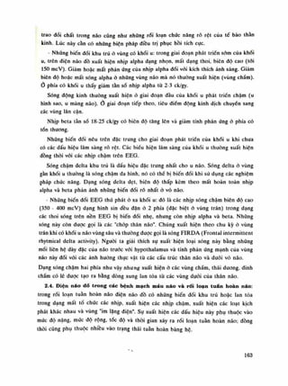 trao dổi chất trong não cũng nhu những rối loạn chức năng rõ rệt của tế bào thằn
kinh. Lúc này càn có những biện pháp điều trị phục hồi tích cục.
- Những biến đổi khu trú ỏ vùng có khói u: trong giai đoạn phát triền sòm của khói
u, trên điện não đồ xuất hiện nhịp alpha dạng nhọn, mất dạng thoi, biên độ cao (tới
150 mcV). Giảm hoặc mất phản ứng của nhịp alpha đối vói kích thích ánh sáng. Giảm
biên độ hoặc mất sóng alpha ỏ nhũng vùng não mà nó thường xuất hiện (vùng chầm).
0 phía có khối u thấy giảm tằn sổ nhịp alpha tù 2-3 ck/gy.
Sóng động kinh thường xuất hiện à giai đoạn đầu của khối u phát triền chậm (u
hình sao, u màng não).Ỏ giai đoạn tiếp theo, tiêu điếm dộng kinh dịch chuyến sang
các vùng lân cận.
Nhịp beta tàn số 18-25 ck/gy có biên độ tăng lên và giảm tính phàn ứng ỏ phía có
tổn thương.
Những biến đối nêu trên dặc trung cho giai đoạn phát triền của khối u khi chua
có các dấu hiệu lâm sàng rõ rệt. Các biếu hiện lâm sàng của khối u thường xuất hiện
dồng thòi vói các nhịp chậm trên EEG.
Sóng chậm delta khu trú là dấu hiệu đặc trung nhất cho u não. Sóng delta ó vùng
gằn khối u thường là sóng chậm đa hình, nó có thể bị biến đồi khi sử dụng các nghiệm
pháp chức năng. Dạng sóng delta dẹt, biện độ thấp kèm theo mất hoàn toàn nhịp
alpha và beta phản ánh nhũng biến dổi rõ nhất ỏ vò não.
- Những biến dổi EEG thứ phát ỏ xa khối u: đó là các nhịp sóng chậm biên độ cao
(350 - 400 mcV) dạng hình sin đều đặn ỏ 2 phía (đặc biệt ỏ vùng trán) trong dạng
các thoi sóng trên nền EEG bị biến đổi nhẹ, nhưng còn nhịp alpha và beta. Nhũng
sóng này còn được gọi là các "chóp thân não". Chúng xuất hiện theo chu kỳ ỏ vùng
trán khi có khối li não vùng sâu và thuồng được gọi là sóng FIRDA (Frontal intermittent
rhytmical delta activity). Nguôi ta giải thích sụ xuất hiện loại sóng này bằng nhũng
mối liên hệ dày đặc của não trước vói hypothalamus và tính phản úng mạnh cùa vùng
náo này đói vói các ánh hường thục vật từ các cấu trúc thân não và dưới vó não.
Dạng sóng chậm hai phía nhu vậy nhung xuất hiện à các vùng chẩm, thái duong, đinh
chấm có lẽ đuọc tạo ra bằng dòng xung lan tỏa tù các vùng dưới của thân não.
2.4. Điện náo dồ trong các bệnh mạch máu náo và rối loạn tuân hoàn náo:
trong rối loạn tuần hoàn não điện não đồ có những biến đổi khu trú hoặc lan tòa
trong dạng mất tổ chức các nhịp, xuất hiện các nhịp chậm, xuất hiện các loạt kịch
phát khác nhau và vùng "im lăng điện". Sụ xuất hiện các dấu hiệu này phụ thuộc vào
mức độ nặng, mức độ rộng, tóc độ và thòi gian xảy ra rối loạn tuần hoàn não; đồng
thòi cũng phụ thuộc nhiều vào trạng thái tuần hoàn bàng hệ.
163
 
