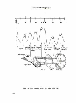 AEP- Các liên quan giãi phẫu
ỉ-ế
Cz<
Hình 128. Hình ghi điện thế do kích thích thính giác.
220
 