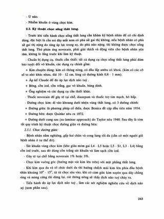 - u não.
- Nhiễm khuẩn ỏ vùng chọc kim.
2.3. Ký thuật chọc sống thát lưng.
- Trước khi tiến hành chọc sống thắt lung càn khám kỹ bệnh nhân đè có chi định
đúng, đặc biệt là càn soi đáy mắt xem có phù nề gai thị không, nếu bệnh nhân có phù
nề gai thị nặng do tăng áp lực trong sọ, do phù não nặng, thì không được chọc sống
thắt lung. Thử phản ứng novocain, phải giải thích và động viên cho bệnh nhân yên
tâm, không lo lắng trước khi làm kỹ thuật.
- Chuẩn bị dụng cụ, thuốc cần thiết: tất cả dụng cụ chọc sống thắt lung phải dám
bảo tuyệt đối vô khuẩn, các dụng cụ chính gồm:
+ Kim chuyên dùng: kim có thông nòng, có đầu lắp ambu có khoa, (kim có các cô
số to nhỏ khắc nhau, dài 10 - 12 em, lòng có dường kính 0,8 - Ì mm).
+ Áp kế Claude để đo áp lực dịch não tuy .
+ Bông, cồn iod, cồn trắng, gạc vô khuẩn, băng dính.
+ Ổng nghiệm và các dụng cụ cần thiết khác.
- Thuốc novocain đế gây tê tại chỗ, diazepam và thuốc trọ tim mạch, hô hấp.
- Đường chọc kim: đi vào khoang dưới hhện vùng thắt lưng, có 3 đuòng chính:
+ Đường giữa: là phương pháp cồ điển, được Bonica đề cập đầu tiên năm 1934.
+ Đường bên: đuọc Quinke nêu ra 1872.
+ Đuòng đuối cung sau (su-laminar approach) do Taylor nêu 1940. Sau đây là tóm
tắt quy trình kỹ thuật chọc đường giữa và đuòng bên:
2.3.1. Chọc dường giữa:
• Bệnh nhân nằm nghiêng, gấp hai chân và cong lưng tói đa (càn có một người giữ
bệnh nhân ó tu thế đó).
- Sát khuẩn vùng chọc kim (khe giữa móm gai L4 - L5 hoặc L5 - SI, L3 - L4) bằng
cồn iod trưốc, sau đó dùng cồn trắng sát khuẩn và làm sạch cồn iod.
- Gây tê tại chỗ bằng novocain 1% hoặc 3%.
- Chọc kim vuông góc (huống mặt vát kim lên trên) vói mặt phang thắt lung.
- Khi kim qua da và tổ chức đuối da thì huống chếch mũi kim lên phía đầu bệnh
nhân khoảng 10° - 15°, tù từ chọc sâu vào, khi có cảm giác kim xuyên qua dây chằng
ràng và màng cứng thì dừng lại, rút thông nòng sẽ thấy dịch não tuy chảy ra.
- Tiến hành đo áp lực dịch não tuy , làm các xét nghiệm nghiên cứu về dịch não
:uý (xem phàn sau).
243
 