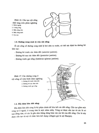 Hình 16. Cấu tạo cột sóng
thắt lung trên phim nghiêng
1. Mỏm ngang
2. Cuống sổng
3. Máu sống trên
4. Mấu sổng dưới
5. Gai sau
1.3. Đường cong sinh lý của cột sống.
Ỏ cột sóng cổ đường cong sinh lý hoi ưỡn ra trước, có thế xác định ba đường bò
liên tục:
- Đưòng bò truâc các thân dốt (anterior juntion).
- Đuòng bò sau các thân đốt (posterior juntion).
- Đường trước gai sóng (laminous spinous juntion).
Hình 17. Các đuòng cong ỏ
cột sống cổ trên bình diện nghiêng
ì. Dương bò trước thân dối
2. Dưòng bà sau thân dồi
3. Dường trước gai sống
Ì 4. Đĩa đệm liên dốt sống.
Đĩa dem liên đốt sóng là bộ phận chính để liên kết các đốt sóng. Cấu tạo gồm một
vòng xo ỏ ngoài, ỏ trung tâm là một nhân nhầy. Vòng xo đuọc cấu tạo từ các lá xo
sun dồng lâm, có các lá gần nhu thẳng dứng bám vào các bò của đốt sống. Các lá này
dưoc cấu tạo tù sợi tổ chúc liên kết dạng collagen gọi là sợi Sharpey.
25
 