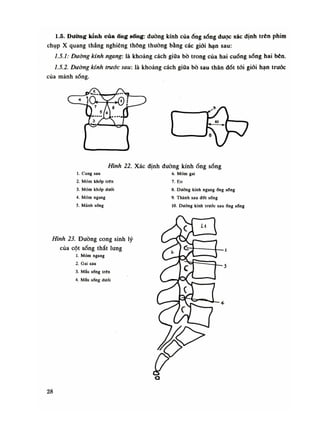 1.5. Đường kính củaống sống: đường kính củaống sống được xác định trẽn phim
chụp X quang thẳng nghiêng thông thường bằng các giói hạn sau:
1.5. : Đường kính ngang: là khoảng cách giữa bò trong của hai cuống sống hai bên.
Ị.5.2. Đường kính trước sau: là khoảng cách giữa bò sau thân đốt tói giói hạn trước
của mành sống.
Hình 22. Xác định đường kínhống sống
1. Cung sau
2. Mõm khớp trên
3. Mỏm khớp đười
4. Mỏm ngang
5. Mảnh sống
Hình 23. Đường cong sinh lý
của cột sống thắt lưng
ỉ. Mỏm ngang
2. Gai sau
3. Mấu sóng trẽn
4. Mấu sống dưới
6. Mỏm gai
7. Eo
8. Dường kính ngangống sổng
9. Thành sau dốt sống
10. Dường kính trước sauổng sổng
28
 