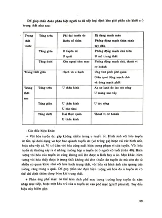 Để giúp chấn đoán phân biệt nguôi ta đã xếp loại định khu giải phẫu các khói u ỏ
trung thất nhu sau:
Trung
thát
trưôc
Tầng trên Phỉ đại tuyến ức
Bướu cổ chìm
DỊ dạng mạch máu
Phổng động mạch thân cánh
tay đẩu.
Trung
thát
trưôc
Táng giữa u tuyến ức
u quái
Phổng động mạch chủ trên
u mỡ trung thất
Trung
thát
trưôc
Tâng dưới Kén ngoại tâm mạc Phổng động mạch chủ, thoát vị
cơ hoành
Trung thất giữa Hạch và u hạch Ung thư phổi phế quản
Giãn quai động mạch chủ
và động mạch phổi
Trung
thất
sau
Tầng trên u thẩn kinh Áp xe lạnh do lao cột sổng
u màng não tùy
Trung
thất
sau
Tâng giữa u thẩn kinh
u bào thai
u cột sống
Trung
thất
sau
Tầng dưới Hai thực quản
u thẩn kinh
Thoát vị cơ hoành
- Các dấu hiệu khác:
+ Vôi hóa tuyến úc: gặp không nhiều trong u tuyến ức. Hình ảnh vôi hóa tuyến
ức tồn tại dưới dạng vỏ bọc bao quanh tuyến ức (vỏ trứng gà) hoặc rải rác hình nót,
hoặc nhu vầy cá. Vị trí dám vôi hóa cũng xuất hiện trong phạm vi của tuyến. Vôi hóa
tuyến ức thường xảy ra ỏ nhũng trường họp u tuyến ức ỏ nguôi có tuổi (trên 40). Hiện
tượng vôi hóa của tuyến ức cũng không nói lên được u lành hay u ác. Mặt khác, hiện
tuông vôi hóa thấy được ỏ trung thất không chi đon thuần do tuyến ức mà còn do tù
nhiều co quan khác nhu vôi hóa hạch trung thất, vôi hóa và hình ảnh cản quang của
xương, răng trong u quái. Đế góp phần xác định hiện tuông vôi hóa do u tuyến ức có
thể chi định thêm chụp bom khí trung thất.
+ Phản úng phế mạc: có thể tràn dịch phế mạc trong truồng họp tuyến ức xâm
nhập trục tiếp, hoặc một khu trú của u tuyến ức vào phế mạc (greff pleural). Tuy dấu
hiệu này hiếm gặp.
59
 