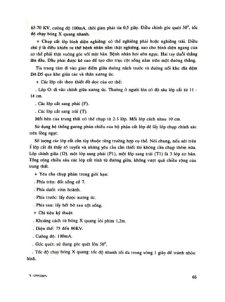 65-70 KV, cuông độ lOOmA, thòi gian phát tia 0,5 giây. Điêu chinh góc quét 50°, tốc
dô chạy bóng X quang nhanh.
+ Chụp cắt lóp bình diện nghiêng: có thế nghiêng phải hoặc nghiêng trái. Điều
chú ý là điều khiên tu thế bệnh nhân nằm thật nghiêng, sao cho bình diện ngang của
co thề phải thật vuông góc vói mặt bàn. Bệnh nhân hoi ưỡn ngục. Hai tay duỗi thẳng
lên đầu. Đầu phải được kê cao đè tạo cho trục cột sống nằm trên một đường thẳng.
Tia trung tâm đi vào giao điểm giữa đuòng nách trước và đường nối khe đĩa đệm
D4-D5 qua khe giữa các và thân xương úc.
+ Các lóp cắt theo thiết đồ dọc cùa co thè:
. Lóp O: đi vào chính giữa xương úc. Thường à nguôi lòn có độ sâu lốp cắt tù l i -
14 em.
. Các lóp cắt sang phải (F).
. Các lóp cắt sang trái (T).
Mỗi bên của trung thất có thể chụp tù 2-3 lóp. Mỗi lóp cách nhau 10 em.
Sú dụng hệ thống gương phản chiếu của bộ phận cắt lóp đề lấy lóp chụp chính xác
trên lồng ngục.
Số lượng các lóp cắt cần tùy thuộc từng truồng họp cụ thể. Nói chung, nếu xét trên
3 lốp cắt đã thấy rõ tuyến và nhũng yêu cầu cần thiết thì không cần chụp thêm nữa.
Lốp chính giũa (O), một lóp sang phải (Fl), một lóp sang trái (TI) là 3 lóp co bản.
Tổng cộng chiều sâu các lớp cắt tính tù đường giũa, không vượt quá chiều rộng của
trung thất.
+ Yêu cầu chụp phim trong giói hạn:
. Phía trên: dốt sóng cố 7.
. Phía đuôi: vòm hoành.
. Phía trước: lấy được xương ức.
. Phía sau: lấy hết bò sau cột sống.
+ Chi tiêu kỹ thuật:
. Khoảng cách tù bóng X quang tói phim l,2m.
. Điện thế: 75 đến 80KV.
. Cuông độ: lOOmA.
. Góc quét: sử dụng góc quét lòn 50°.
. Tốc độ chạy bóng X quang: tốc độ nhanh tối đa trong vòng Ì giây đề tránh nhòe
hình.
"5 - CPPCBBTV 65
 