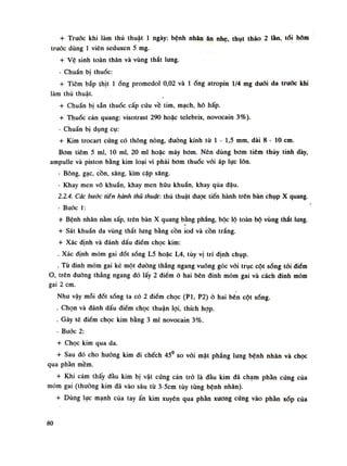 + Trước khi làm thủ thuật Ì ngày: bệnh nhân ăn nhẹ, thụt tháo 2 lằn, tói hôm
trước dùng Ì viên seduxen 5 mg.
+ Vệ sinh toàn thân và vùng thắt lung.
- Chuẩn bị thuốc:
+ Tiêm bắp thịt Ì ống promedol 0,02 và Ìống atropin 1/4 mg đuôi da truốc khi
làm thủ thuật.
+ Chuẩn bị sẵn thuốc cấp cứu về tim, mạch, hô hấp.
+ Thuốc cản quang: visotrast 290 hoặc telebrix, novocain 3%).
- Chuẩn bị dụng cụ:
+ Kim trocart cứng có thông nòng, đuòng kính tù Ì - 1,5 Dim, dài 8 - 10 em.
Bom tiêm 5 mi, 10 mi, 20 mi hoặc máy bom. Nên dùng bom tiêm thủy tinh dày,
ampulle và piston bằng kim loại vì phải bom thuốc vói áp lục lốn.
- Bông, gạc, cồn, sáng, kìm cặp sàng.
- Khay men vô khuẩn, khay men hữu khuẩn, khay qua đậu.
2.2.4. Các bước tiên hành thủ thuật: thù thuật được tiến hành trên bàn chụp X quang.
- Đuốc 1:
+ Bệnh nhân nằm sấp, trên bàn X quang bằng phang, bộc lộ toàn bộ vùng thắt lung.
+ Sát khuẩn da vùng thắt lung bằng cồn iod và cồn trắng.
+ Xác định và đánh dấu điểm chọc kim:
. Xác định móm gai đốt sống L5 hoặc L4, tùy vị trí định chụp.
. Tù đinh mỏm gai kẻ một đường thẳng ngang vuông góc vối trục cột sóng tói diêm
o, trên đường thẳng ngang đó lấy 2 điềm ỏ hai bên đinh mỏm gai và cách dinh mỏm
gai 2 em.
Nhu vậy mỗi đốt sống ta có 2 điểm chọc (Pl, P2) ỏ hai bên cột sống.
. Chọn và đánh dấu điếm chọc thuận lọi, thích họp.
. Gây tê điểm chọc kim bằng 3 mi novocain 3%.
- Bước 2:
+ Chọc kim qua da.
+ Sau đó cho huống kim đi chếch 45° so với mặt phăng lung bệnh nhân và chọc
qua phần mềm.
+ Khi cảm thấy đầu kim bị vật cứng cản trỏ là đầu kim đã chạm phần cứng của
mỏm gai (thường kim đá vào sâu từ 3-5cm tùy tùng bệnh nhân).
+ Dùng lực mạnh của tay ấn kim xuyên qua phần xương cứng vào phàn xốp của
80
 
