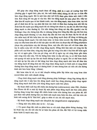 Đế giúp cho chụp động mạch được dễ dàng, nhất là ỏ một sò truồng họp khó
(thường gặp ỏ nguôi béo, phụ nữ, lúa tuổi thiếu niên) chúng tôi dã tạo ra kim dẫn
kim chụp động mạch. Đó là một kim nhỏ (số 61/2) được giũa thêm một rãnh ỏ dốc
kim. Kim dùng để vừa gây tê vừa hút. Khi vào động mạch thì máu phụt lên. tiếp tục
đâm kim đế xuyên qua cả hai thành trước, sau của động mạch, tháo bom tiêm, tay trái
giũ cố định kim dó lại, tay phải đặt kim vào rãnh và đâm theo huống kim nhỏ khi dụ
đoán kim đã xuyên qua động mạch thì rút thông kim nhọn ra, sau dó rút dần kim chụp
dộng mạch ra nhu thuòng lệ. Cải tiến thông kim dùng sợi dây dẫn (guide) của bộ
Seldinger thay cho thông kim dầu tù (nhưng thông kim bằng dây dẫn này dài hon kim
chụp động mạch khoảng 1,5 em, đoạn dây dẫn dài hon này đã dược lấy bỏ lõi sắt dế
cho mềm mại) đế khi luồn kim vào sâu trong động mạch dược dễ dàng và không gây
tốn thương thành mạch. Cải tiến bom tiêm: tù bom tiêm rccord, lắp thêm đàu ambu
xoáy vào đầu bom tiêm dể có thể văn ohặt vào dốc kim cùa đoạn dây nối bằng polythylen
(đoạn dây polỵethylen này dài khoảng 20cm, một đầu đốc kim nối vối kim tiêm, đầu
kia là ambu xoáy nối vói đốc chụp động mạch). Đồng thòi làm một cái vòng ôm lấy
phần cuối của bom tiêm, vòng này được gắn hai vòng tròn nhỏ ỏ hai bên dể luồn ngón
tay trò và ngón giũa. Cán cùa pit tông, noi đế tỳ ngón tay cái cũng duọc gắn thêm
một vòng tròn nhó nứa. Vói hệ thống bom tiêm và dây nói này, ta có thế bom thuốc
cản quang vói một áp lực lòn mà thuốc không bị phụt ra ngoài. Do có thế bom thuốc
vói một áp lục lòn nên có thể dùng loại kim chụp động mạch nhỏ hon đế dâm kim
vào dộng mạch dễ dàng hon mà vẫn chụp dược động mạch có hình ảnh ró ràng (bình
thuòng kim chụp động mạch có đường kính 1,4 mm nhung kim cải tiến chi cần duòng
kính nhò hon hoặc bằng l,26mm).
Khi bom tiêm bị vỡ, ta có thể chuyến những phàn lắp thêm này sang bơm tiêm
record khác một cách nhanh chóng.
- Chụp hình động mạch cảnh bằng phương pháp Seldinger: dùngống thông đấy tù
động mạch dùi ỏ nếp bẹn lên dộng mạch cảnh hay dùng phương pháp chụp ngược
dòng động mạch dưới đòn (chi dùng động mạch cành bên phải).
- Kỹ thuật cMết suất hay đối chiếu âm dương bản (substracsion): năm 1961, Ziedees
Des Plente đã đề ra một kỹ thuật lấy một phim chụp dộng mạch âm bản (nhu phim
thuồng dùng trong lâm sàng) đối chiếu hoàn toàn trên dương bản của phim đó, kết
quà đuọc một phim dương bản cùa hình ảnh mạch máu hiện lên đen, nối bật trên các
hình ảnh xuong đã bị "khử bót", giúp ta nhìn rõ các chi tiết mạch máu.
- Kỹ thuật chụp dộng mạch náo khuyếch đại (magniíication angiography):
+ Dùng một tiêu điềm nhò từ 0,1 - 0,3 min.
+ Co quan chụp đạt cách xa phim hon so vói cách chụp phim thông thuồng. Vói
kỹ thuật này các chi tiết nhó bé sẽ hiện lên phim rất lớn, đặc biệt có lọi trong chần
đoán bệnh lý mạch máu não.
88
 