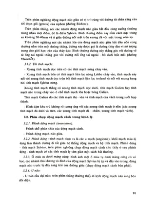 Trên phim nghiêng động mạch não giữa có vị trí trùng vối đường từ chân răng cửa
tói đoạn gối (genou) của siphon (dường Richter).
Trên phim thẳng, noi các nhánh động mạch náo giũa bắt đầu cong xuống thuồng
trùng nhau một điểm, dó là điềm Sylvien. Bình thường điếm này nằm cách mặt trong
sọ khoáng 30-40mm và ỏ giũa đuòng nối mặt trên xương đá vối mặt trong vòm sọ.
Trên phim nghiêng noi các nhánh lên của động mạch não giũa bắt đàu uốn cong
thường nằm trên một dường thẳng, dường này đuọc gọi là đường thúy đảo vì nó tượng
trung cho giói hạn trên của thúy đảo. Bình thuồng đường này thẳng góc vói đường vẽ
tù ống tai ngoài thẳng góc vối dường nóiống tai ngoài - bò đuối hốc mắt (duòng
Vlaovitch).
3.1.2. Thì tĩnh mạch:
• Xoang tĩnh mạch dọc trên có các tĩnh mạch nông chảy vào.
- Xoang tĩnh mạch bên có tĩnh mạch liên lạc nông Labbe chày vào, tĩnh mạch này
nối vối xoang tĩnh mạch dọc trên bói tĩnh mạch liên lạc troland và nối vói xoang hang
bói tĩnh mạch Sylvius nông.
Xoang tĩnh mạch thẳng có xoang tĩnh mạch dọc duỗi, tĩnh mạch Galỉen hay tĩnh
mạch não trong chảy vào ỏ chỗ tĩnh mạch lòn hoặc bóng Galien.
Tĩnh mạch Galien do các tĩnh mạch thị - vân và tĩnh mạch cùa vách trong suốt họp
thành.
- Hình đậm khu trú không rõ tuông ứng vói các xoang tĩnh mạch ỏ nền (các xoang
tĩnh mạch đá đuối và trẽn, các xoang tĩnh mạch đá - chẩm, xoang tĩnh mạch vành).
3.2. Phim chụp dộng mạch cảnh trong bệnh lý.
3.2.1. Phình động mạch (anevrysme):
- Phình chỗ phân chia cùa động mạch cảnh.
- Phình động mạch não giũa.
3.2.2. Phình dộng - tĩnh mạch: thục ra là các u mạch (angiome), khối mạch máu dị
dạng làm thành đuòng đi tắt giũa hệ thống động mạch và hệ tĩnh mạch. Phình động
- tĩnh mạch Sylvius, trên phim nghiêng chụp động mạch cành cho thấy ò sau phình
động - tĩnh mạch có các tĩnh mạch ly tâm giãn một cách bất thường.
3.2.3.Ổ máu tụ dưới màng cứng: hình ảnh mộtổ máu tụ đuôi màng cúng có vỏ
bọc, các nhánh thái dương và đinh của động mạch Sylvius bị ép và đấy vào trong, dộng
mạch não trước bị đấy sang trái của đuòng giũa (chụp động mạch cảnh bên phái).
3.2.4. u não:
• u bán cầu dại não: trên phim thẳng thuòng thấy đi lệch động mạch não sang bên
dối diện.
91
 