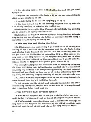 - u thúy trán: động mạch não trước bị đáy rất nhiêu, động mạch não giữa có thè
bị dấy ra sau.
- u thúy đinh: trên phim thẳng, điếm Sylvius bị dẩy lên trên, trên phim nghiêng các
nhánh náo giữa cũng bị dẩy lên trên.
- u náo thất: thuồng chi cho thấy tình trạng tăng áp lục nội sọ.
- u thúy chẩm: thường ít thay đổi trên phim chụp động mạch cảnh, tuy nhiên nếu
u lốn nó cũng có thể đấy các nhánh hão giũa ra phía trước.
Dấu hiệu Fisher gần: trên phim thẳng, dộng mạch não truóc bị dẩy vồng qua duòng
giũa do u thúy trán đè trục tiếp vào lfêm đại não.
Dấu hiệu Fisher xa: động mạch não trước bị đấy qua diiòng giũa nhung không dấy
vồng mà chạy song song vối đường giữa do khối u ỏ xa (ví dụ: u thúy thái dương, u
thúy chầm) không dè trực tiếp lên liềm đại náo.
3.3. Phim chụp dộng mạch dốt sống bình thường.
3.3.1. Thì động mạch: động mạch đốt sống đi qua lỗ chẩm vào sọ, nói vói động mạch
đốt sóng đối diện ỏ truóc hành não làm thành động mạch thân nên. Truóc đó dộng
mạch đốt sống đã cho động mạch tiếu não đuôi. Thân nền cho các động mạch tiểu
não giữa và trên, sau đó chia thành hai nhánh chính, đó là các động mạch não sau,
động mạch này cho: động mạch nói sau, các dộng mạch màng mạch sau, các nhánh
thái dương, thái dương - chẩm và các động thạch chẩm trong. gàn chỗ phân chia,
thân nền còn cho các động mạch mảnh (artẽres greles) đến các đồi thị.
Trên phim nghiêng động mạch tiếu não đuối vẽ thành hai đường cong: (luồng cong
đàu tiên có bề lồi huống xuống đuôi gọi là đường cong hành não vì nó ôm sát hành
não, đường cong thứ hai có bồ lồi huống lên trên gọi là đuòng cong hạnh nhân vì nó
bao quanh hạnh nhân tiếu não, hai đuòng cong này nói vói nhau tại điếm mạng mạch, điếm
này, thuồng nằm trên đường trung trục của đường nối mấu yên trưóc vớiụ chấm trong.
3.3.2. Thì tĩnh mạch: thấy đuọc xoang tĩnh mạch dọc trên, các xoang tĩnh mạch bên,
xoang tĩnh mạch thẳng họp lại ỏ chỗ hội lưu Herophile.
Thì tĩnh mạch còn cho thấy: các tĩnh mạch chẩm, các tĩnh mạch tiểu não trên và
duỗi các xoang tĩnh mạch đá, chảy vào đó có các tĩnh mạch đá, các xoang tĩnh mạch
vành và hang bóng Galien và tĩnh mạch nền.
4. PHIM CHỤP DỘNG MẠCH ĐỐT SỐNG BỆNH LÝ
4.1. u hổ sọ sau: động mạch não sau bên có u bị đẩy lên trên hay vào trong, ra
ngoài, tùy theo vị trí của u, sụ dẩy. lệch này làm mất đối xứng của động mạch náo sau.
4.2. u tiểu náo trái: phim thẳng thì động mạch có thề thấy hình hoa tulipe của
động mạch não sau, động mạch tiều não đuối bị đẩy sang phải và kéo dài các nhánh
tận thì tính mạch cho thay các tĩnh mạch tiếu não biến dạng, bao quanh khói u.
92
 
