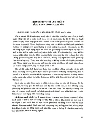 NHẬN ĐỊNH VỊ TRÍ CỦA KHỐI u
BẰNG CHỤP ĐỘNG MẠCH NÃO
1. ÁNH HƯỞNG CUẨ KHỐI u NÃO LÊN CẤC ĐỘNG MẠCH NÃO
Các u não dè dẩy lên các dộng mạch não và bản (hân có thề có một cấu trúc huyết
quản riêng biệt: cố u nhiều mạch máu, có u ít mạch máu. Sự đè dầy lên các huyết
quản não phụ thuộc hoặc phát triền theo lói thâm nhiễm (infiltratif) hoặc theo lối tỏa
lan to ra (expansií). Nhũng huyết quản riêng biệt của khối u gọi là huyết quàn bệnh
lý, khác vói nhũng huyết quàn thường là có rò những dộng mạch - tĩnh mạch. Do đó,
khi dang ỏ giai đoạn dộng mạch mà thuốc dã qua mạng lưới mao mạch dày dặc của
khối u, làm khối u ngấm thuốc một cách thuần nhất. Tốc độ máu chảy trong khối u
thuồng chậm chạp làm cho khói u ngấm thuốc tuông đói lâu hon và kém dậm hon.
Chung quanh nhũng chỗ hoại tử tố chức não, thường thấy ngấm các huyết quản xếp
theo hình vòng cung. Trong một số trường họp, u không có cấu trúc huyết quản riêng
biệt. Nhũng nang kén, áp xe, các khối máu tụ trong não không có mạch máu, chúng
tạo ra một vùng khuyết, đẩy các huyết quản ra xa.
Khó có thể nhận định được kích thước thật của khối u bằng cách căn cú vào kích
thước cùa vùng có động mạch bị đè dầy vì quanh khối u thường có một vùng não bị
phù nê. Chi khi nào toàn bộ khối u ngấm thuốc nhu truồng họp các u màng não có
nhiêu mạch máu mói có thề chân đoán được khối u khá đúng vói vị trí và kích thước
thật của nó.
Sụ dè đầy lên các dộng mạch rõ nhất ó nhũng vùng mà não dễ di dộng, thí dụ:
vùng trán, vì ỏ đây giũa bò đuôi cùa liêm đại não và thế chai, có một khoảng trung
gian rộng. Bế giũa bán cầu rất cao và lan ra xa phía trước. Bói vậy một u vùng trán
dấy rất rõ động mạch quanh thề chai (arteri pericallose) sang phía lành, tạo ra dấu
hiệu Fischer thấy ngay trên phim chụp thẳng.
1.1. Dộng mạch cảnh: khi di quanh nền sọ và xoang hang (sinus caveneux), dộng
mạch cảnh có thế bị một u ỏ vùng này dẩy. Một u nền sọ đẩy siphon lên cao, làm lộ
rõ hố yên ỏ phía đuôi. Trái lại một sarcom phát triển tù màng não có thế dẩy đoạn
này của dộng mạch cảnh thành một hình vòng cung rộng xuống phía đuôi, nhưng nhận
dinh hình dè dẩy lên dộng mạch cảnh cần thận trọng vì đuòng di cùa động mạch này
thay dối nhiều, nhất là ò vùng siphon.
93
 