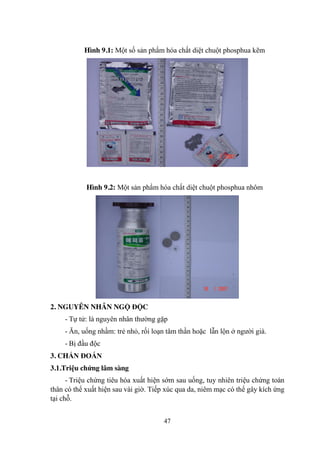 47
Hình 9.1: Một số sản phẩm hóa chất diệt chuột phosphua kẽm
Hình 9.2: Một sản phẩm hóa chất diệt chuột phosphua nhôm
2. NGUYÊN NHÂN NGỘ ĐỘC
- Tự tử: là nguyên nhân thƣờng gặp
- Ăn, uống nhầm: trẻ nhỏ, rối loạn tâm thần hoặc lẫn lộn ở ngƣời già.
- Bị đầu độc
3. CHẨN ĐOÁN
3.1.Triệu chứng lâm sàng
- Triệu chứng tiêu hóa xuất hiện sớm sau uống, tuy nhiên triệu chứng toàn
thân có thể xuất hiện sau vài giờ. Tiếp xúc qua da, niêm mạc có thể gây kích ứng
tại chỗ.
 
