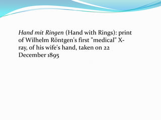 Hand mit Ringen (Hand with Rings): print
of Wilhelm Röntgen's first "medical" X-
ray, of his wife's hand, taken on 22
December 1895
 