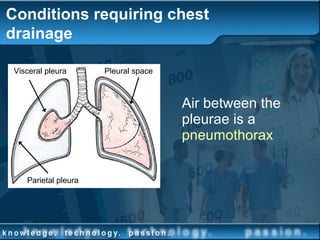 Conditions requiring chest
drainage
Air between the
pleurae is a
pneumothorax
Parietal pleura
Visceral pleura Pleural space
 