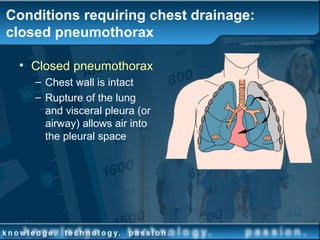 Conditions requiring chest drainage:
closed pneumothorax
• Closed pneumothorax
– Chest wall is intact
– Rupture of the lung
and visceral pleura (or
airway) allows air into
the pleural space
 