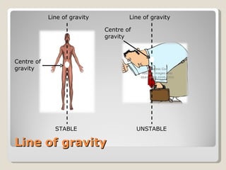 Line of gravity Centre of gravity STABLE Centre of gravity UNSTABLE Line of gravity Line of gravity 