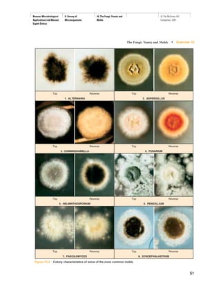 Benson: Microbiological
Applications Lab Manual,
Eighth Edition
II. Survey of
Microorganisms
10. The Fungi: Yeasts and
Molds
© The McGraw−Hill
Companies, 2001
The Fungi: Yeasts and Molds • Exercise 10
51
Top Reverse
1. ALTERNARIA
Top Reverse
2. ASPERGILLUS
Top Reverse
3. CUNNINGHAMELLA
Top Reverse
4. FUSARIUM
Top Reverse
5. HELMINTHOSPORIUM
Top Reverse
6. PENICILLIUM
Top Reverse
7. PAECILOMYCES
Top Reverse
8. SYNCEPHALASTRUM
Figure 10.4 Colony characteristics of some of the more common molds
 