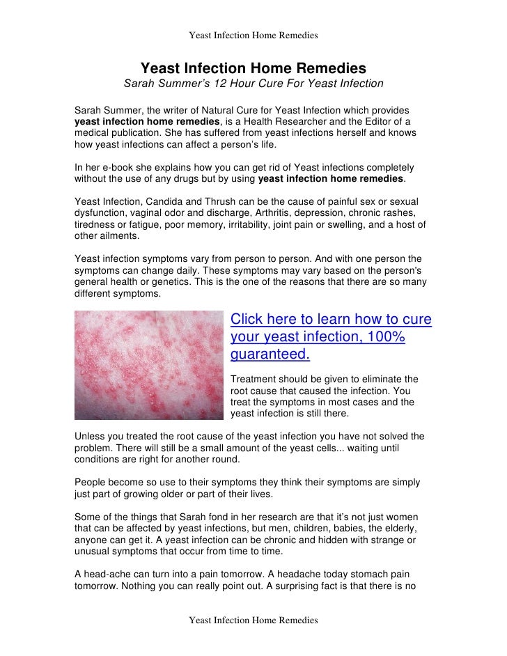 how to cure yeast infection at home
