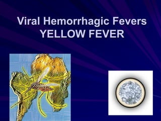Viral Hemorrhagic Fevers
YELLOW FEVER
 