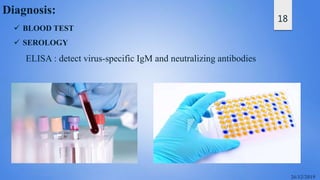 18
Diagnosis:
 BLOOD TEST
 SEROLOGY
ELISA : detect virus-specific IgM and neutralizing antibodies
 