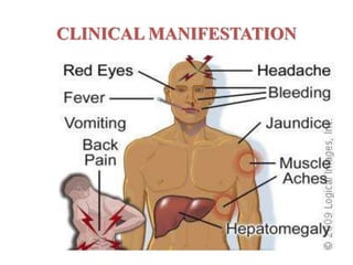 CLINICAL MANIFESTATION
 