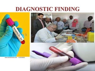 DIAGNOSTIC FINDING
 