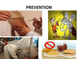 PREVENTION
 