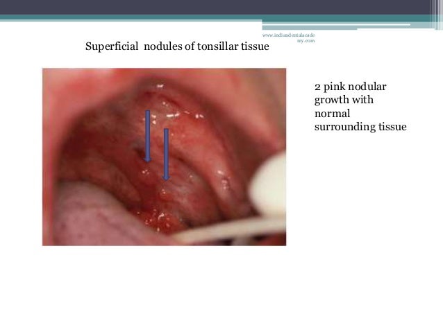 Yellowish conditions of oral cavity