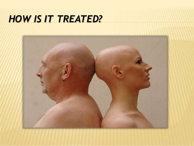 Reverse Traction Alopecia With Arganrain Regrow Your Hair Naturally