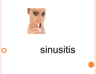  sinusitis
 