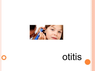  otitis
 