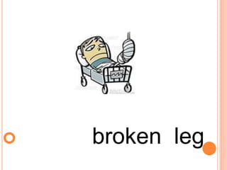  broken leg
 