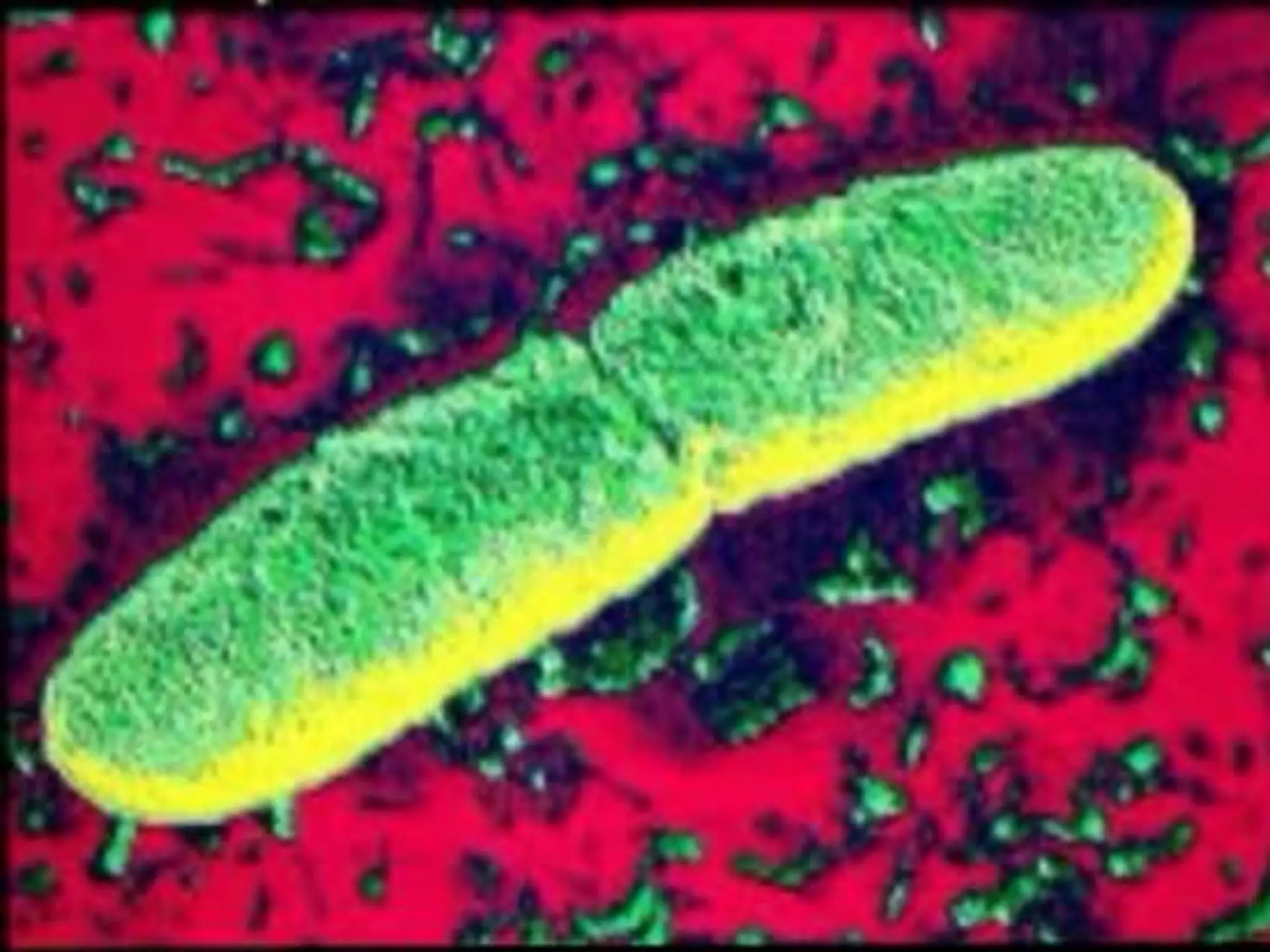 Urease Yersinia Yersinia | PPTX