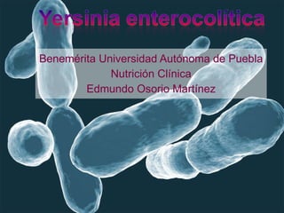 Benemérita Universidad Autónoma de Puebla Nutrición Clínica Edmundo Osorio Martínez 