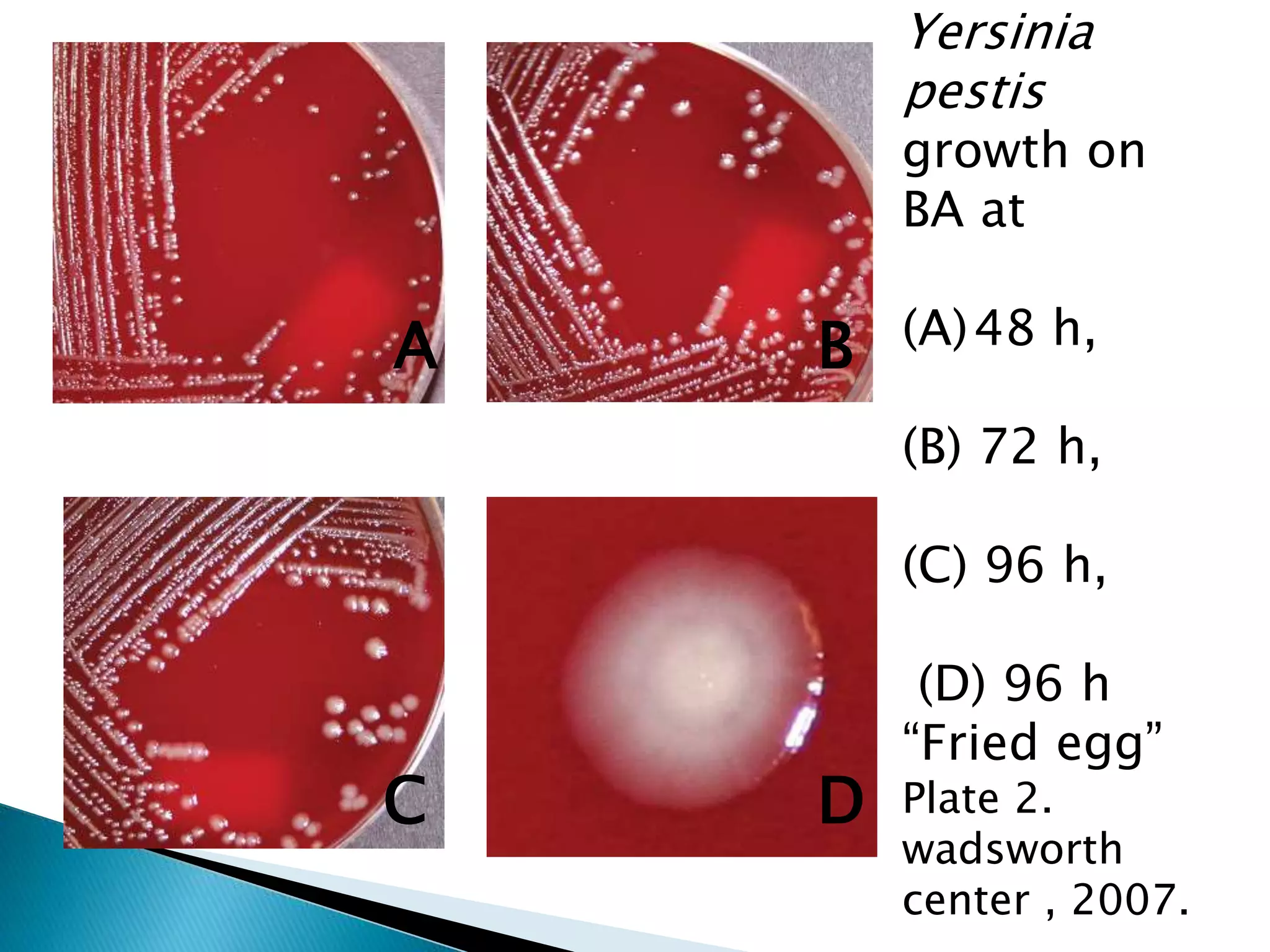 Yersinia Pestis PPTX Yersinia Pestis PPTX