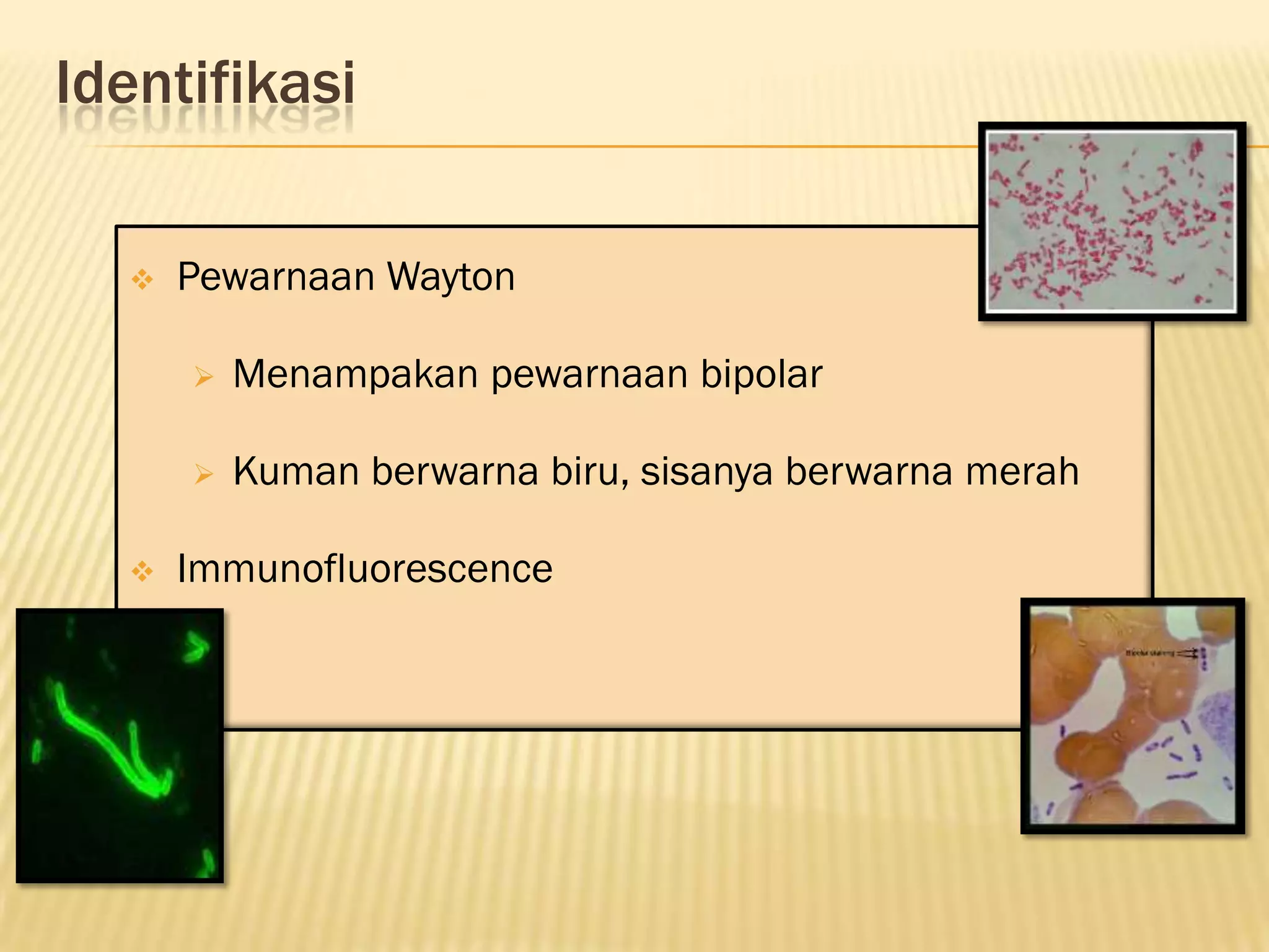 Identifikasi

     Pewarnaan Wayton

         Menampakan pewarnaan bipolar

         Kuman berwarna biru, sisanya berwarna merah

     Immunofluorescence
 