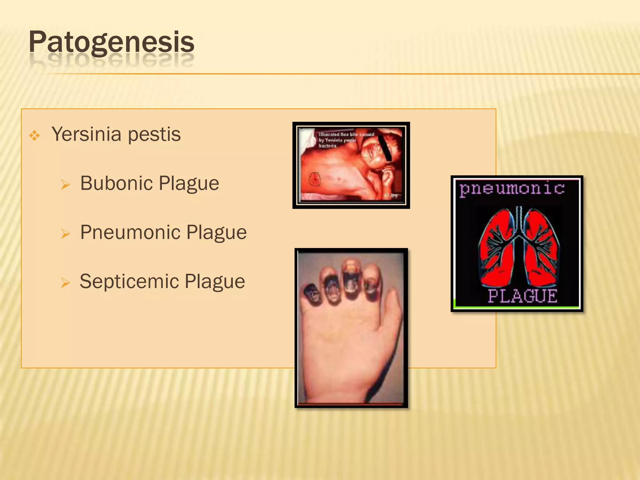 Patogenesis

   Yersinia pestis

       Bubonic Plague

       Pneumonic Plague

       Septicemic Plague
 