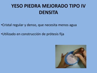 YESO PIEDRA MEJORADO TIPO IV
DENSITA
•Cristal regular y denso, que necesita menos agua
•Utilizado en construcción de prótesis fija
 