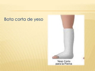 Yeso exp